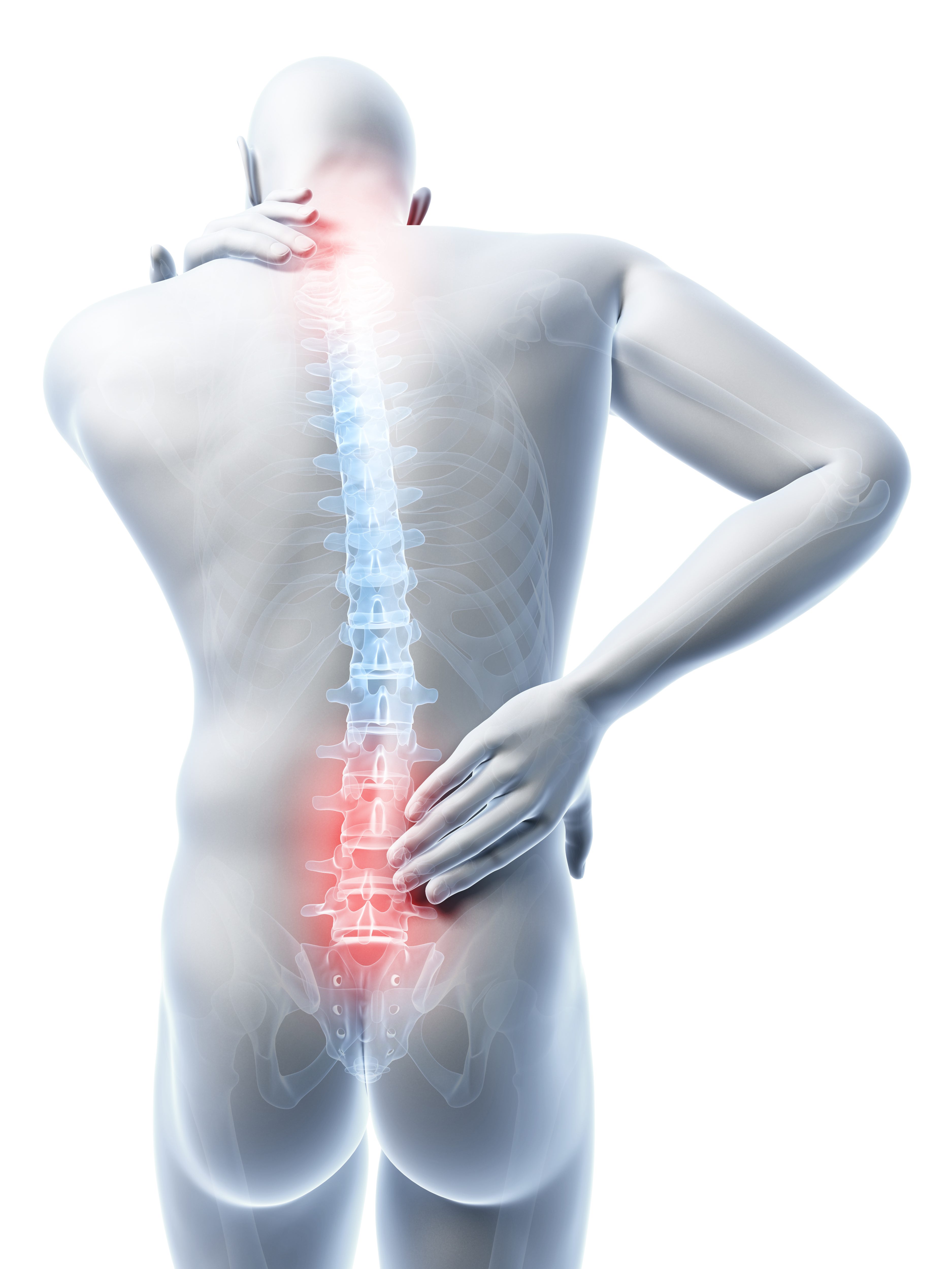Chiropractic management of post spinal cord stimulator spine pain